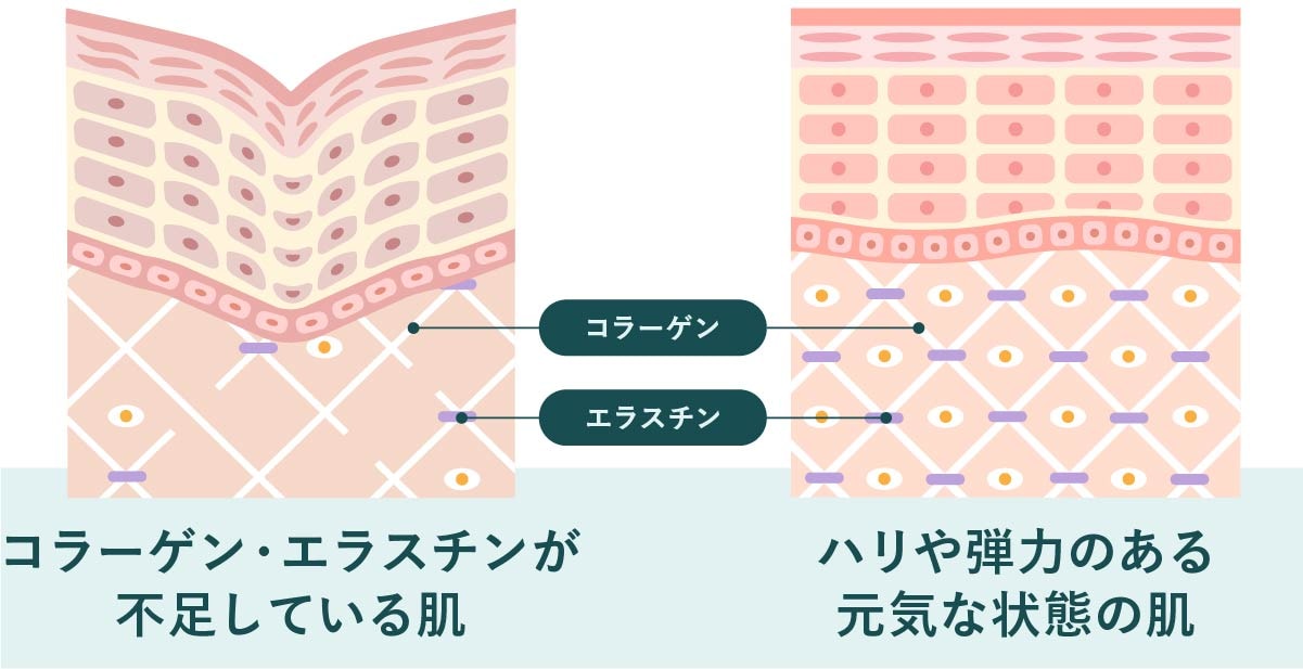 たるみ改善・肌質改善