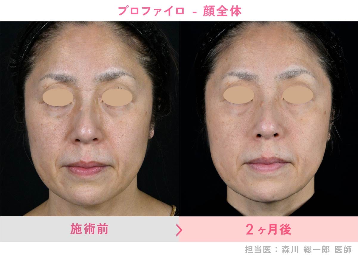 顔の症例