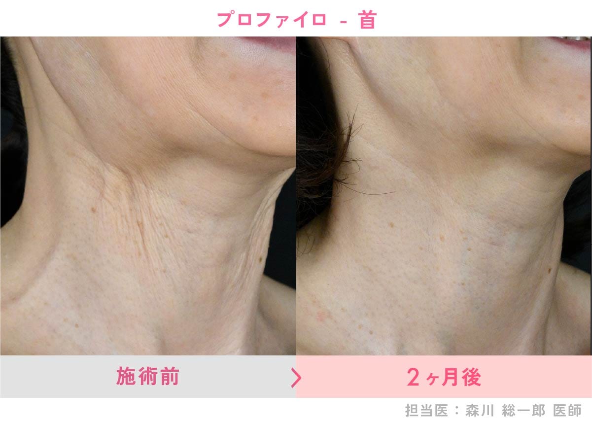 首の症例