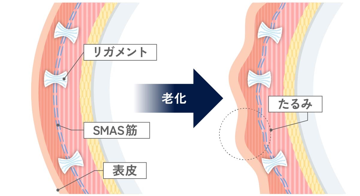 リガメントと老化の関係図