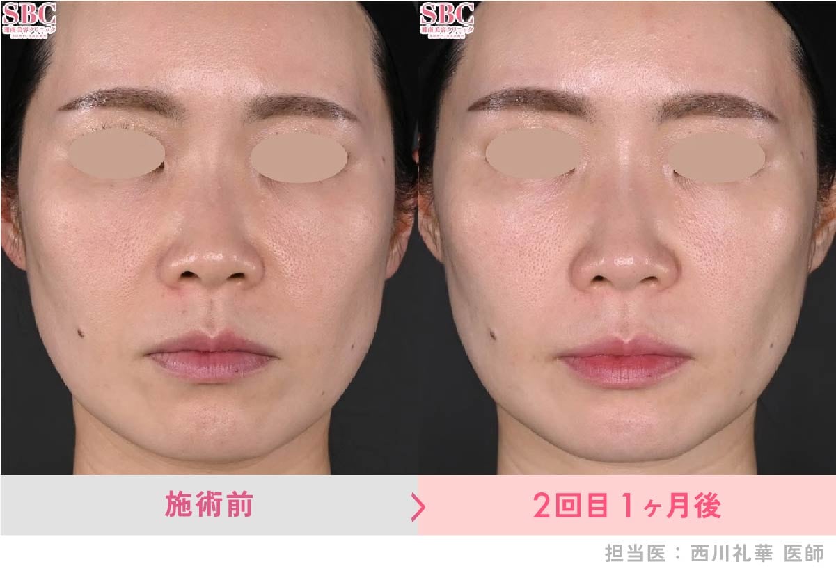 ジャルプロ症例写真