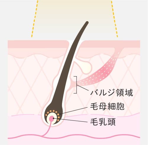 エステ脱毛の効果