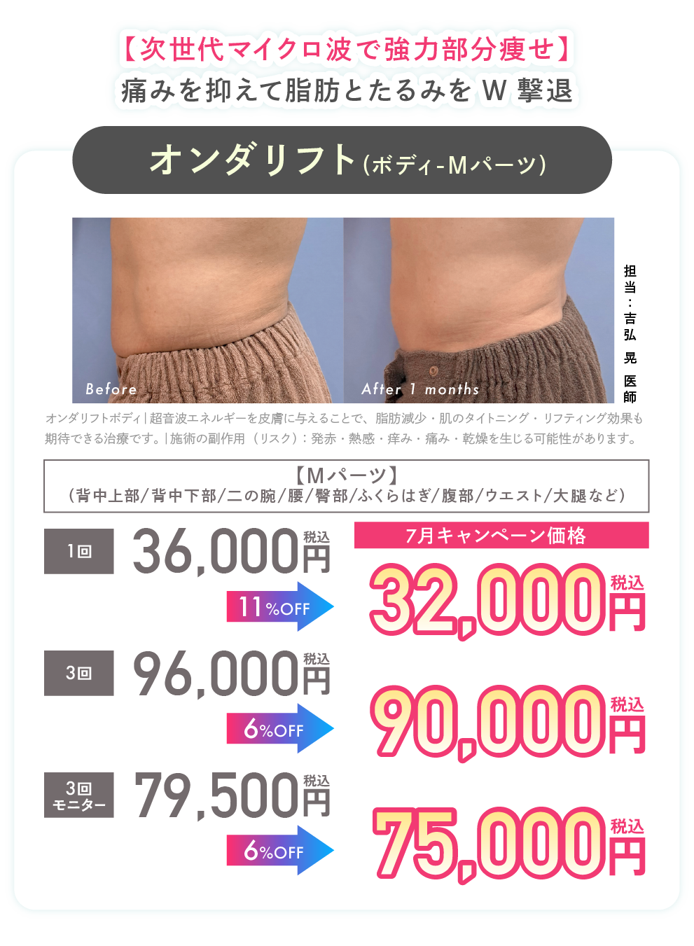 オンダリフト