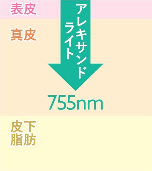 波長:アレキサンドライト