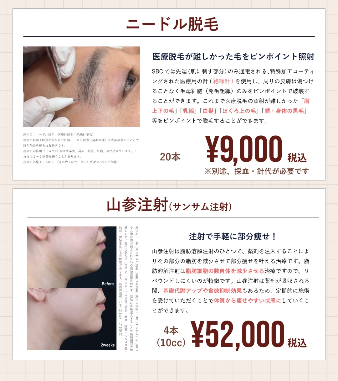 6月はニードル脱毛・山参注射がお得
