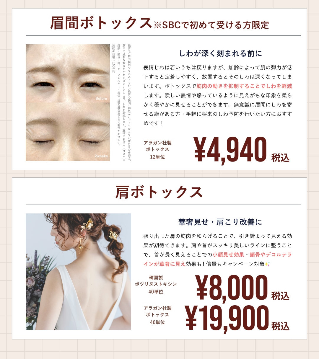 6月はボトックスがお得