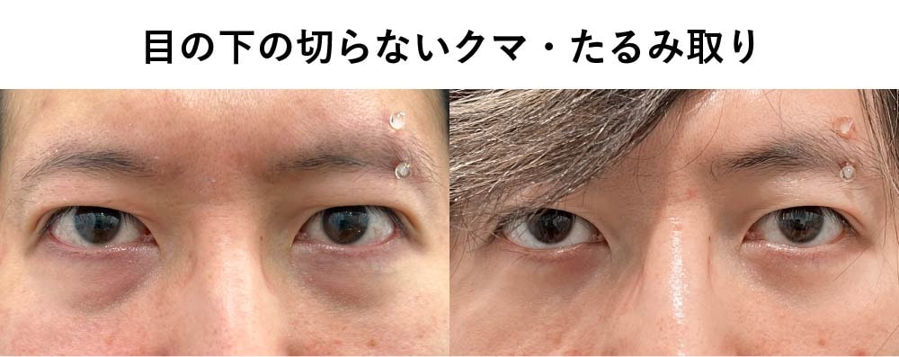 症例写真