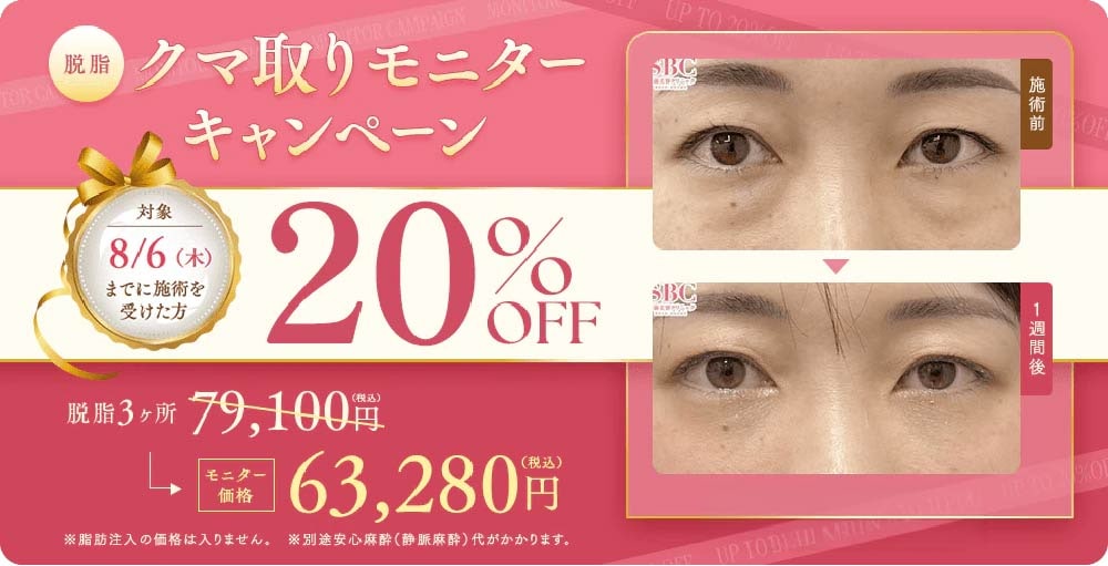 目の下のクマ・たるみ取り