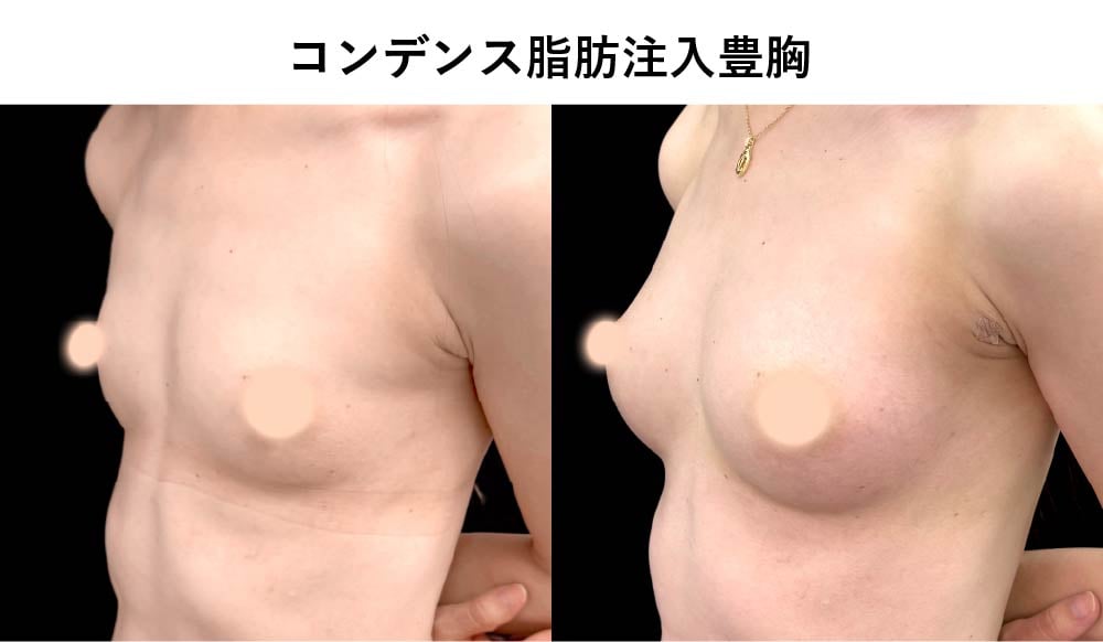 症例写真