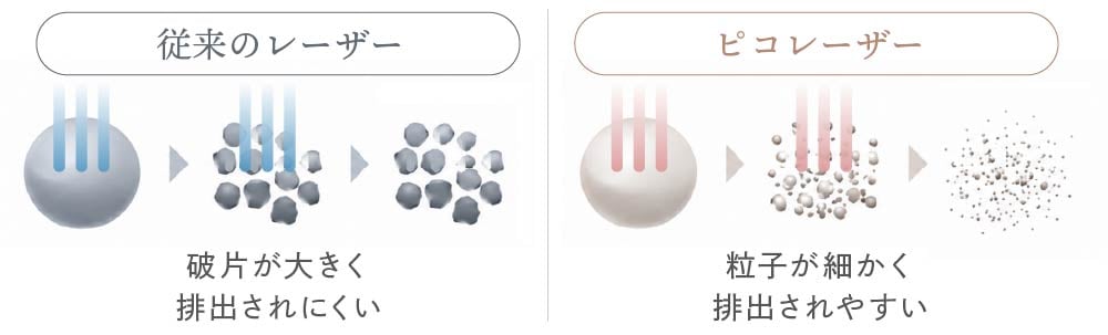 ピコレーザーと従来レーザー（ナノ秒）のシミ粉砕効果の比較図