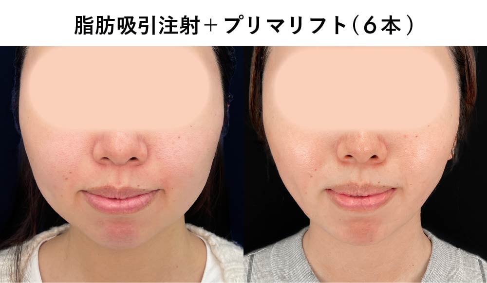20代の症例写真