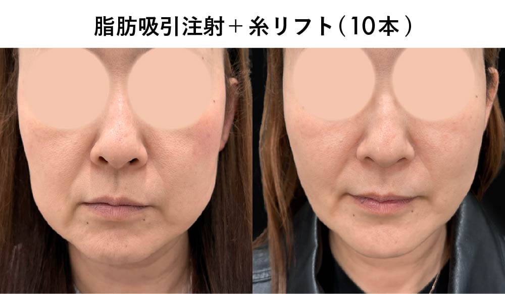 50代の症例写真