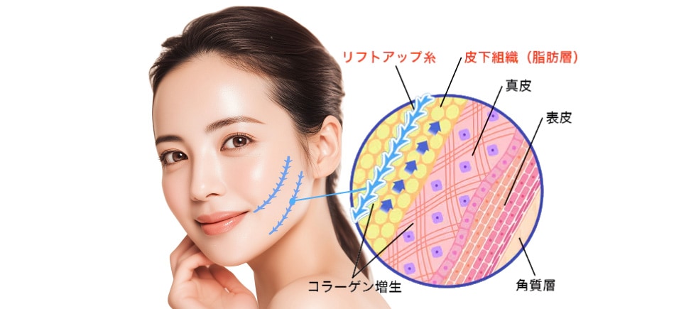 治療の仕組み