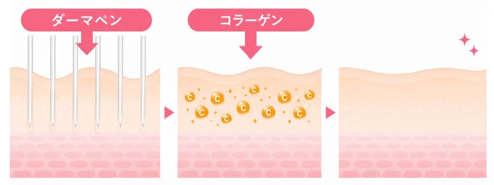 「創傷治癒力」×「薬剤浸透」のダブルアプローチ