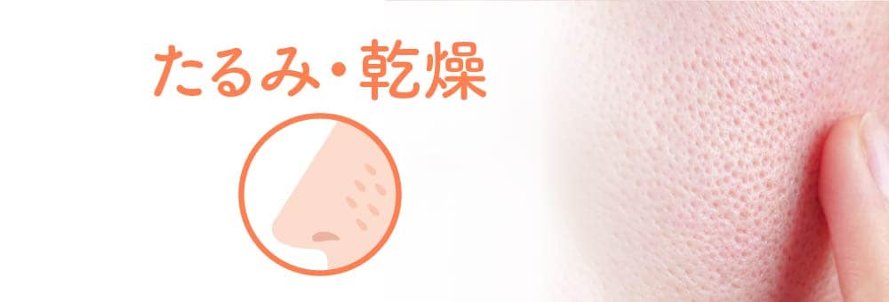 たるみ・乾燥毛穴のイメージ