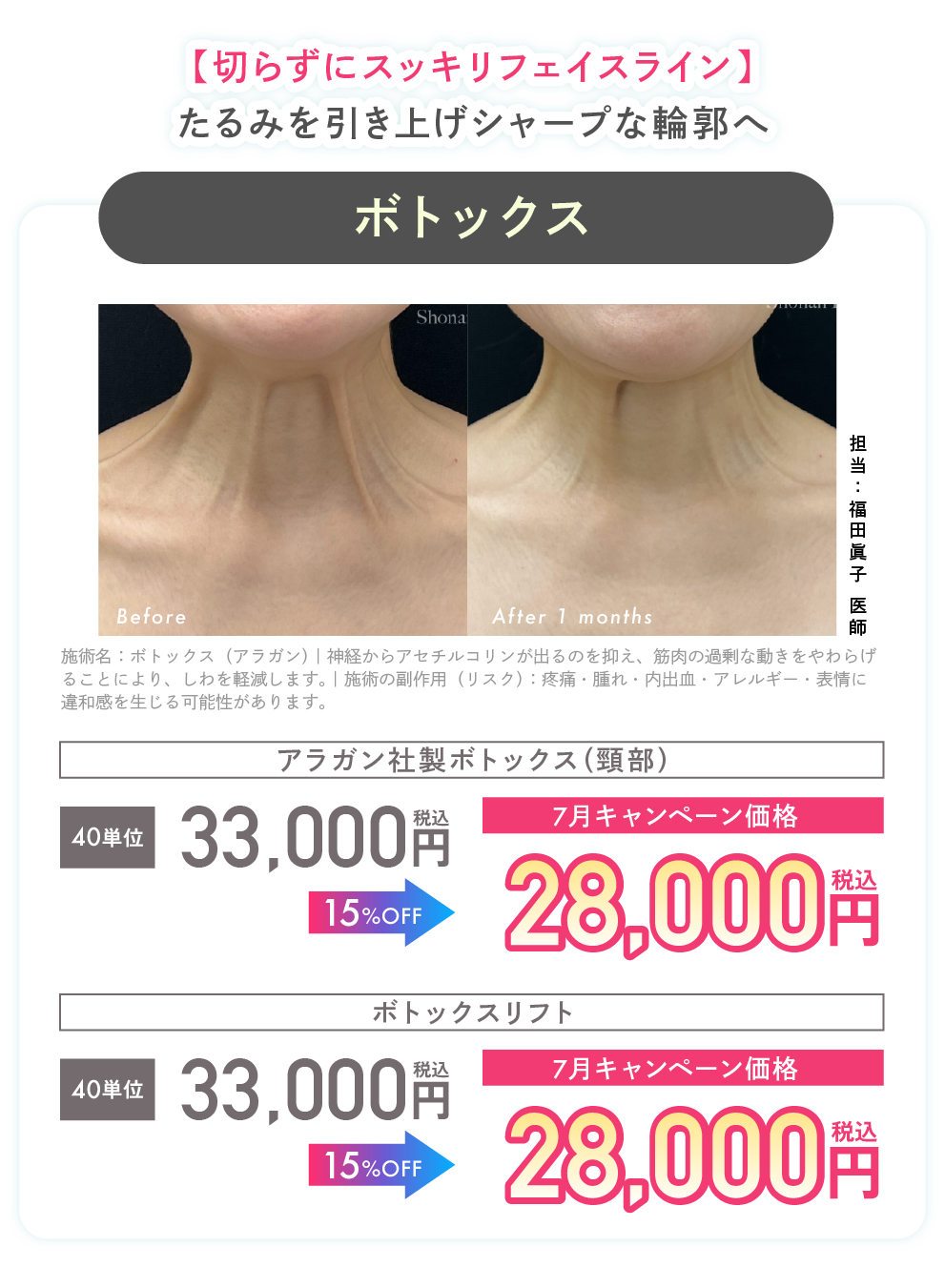 ボトックス