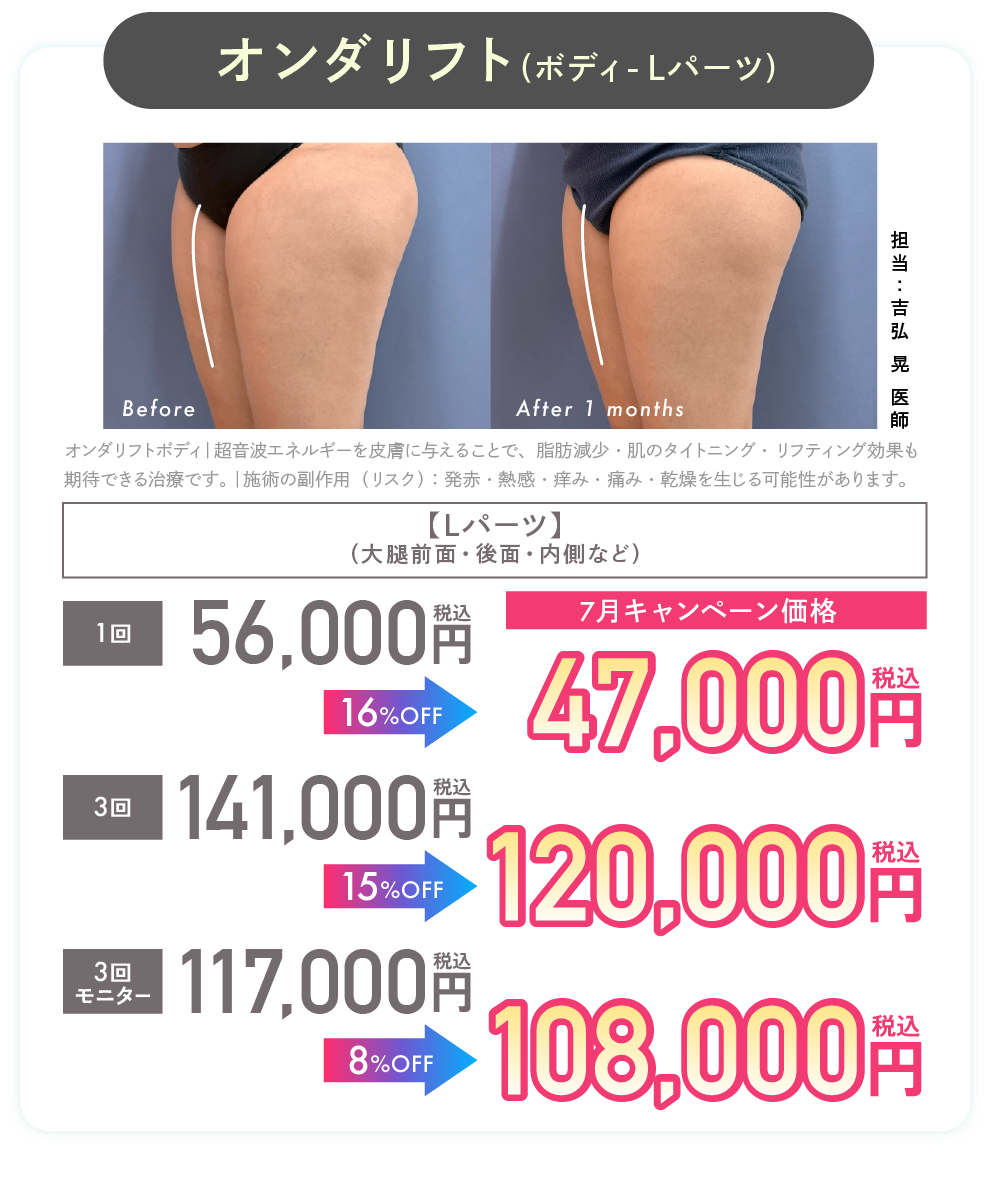 オンダリフト2