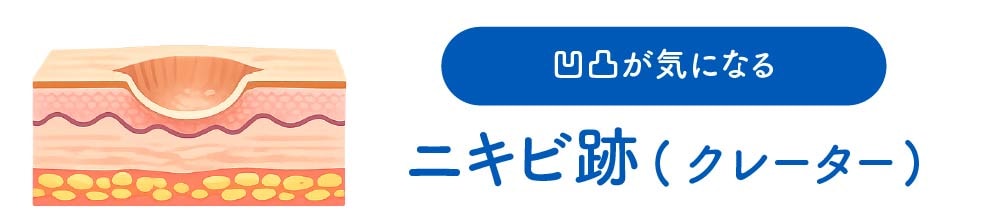 ダーマペン4 シルファームX
