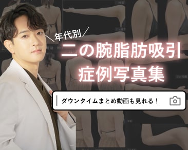 【京都・大阪・滋賀で脂肪吸引を検討中の方へ】二の腕の脂肪吸引症例集