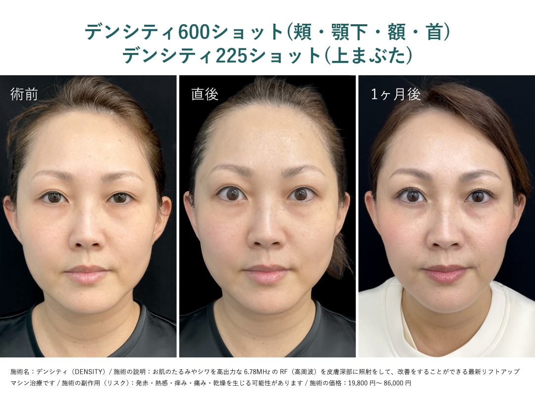 即効性がある