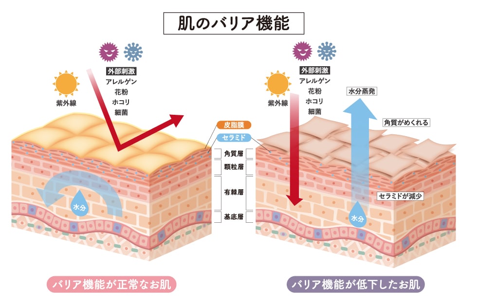 バリア機能の低下