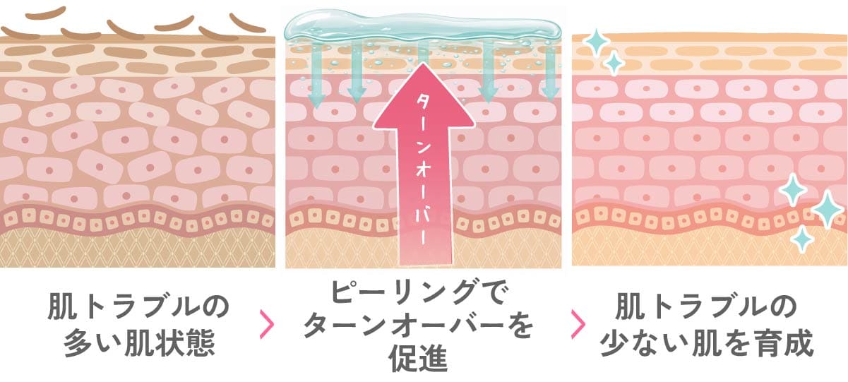京都でケミカルピーリングなら湘南美容クリニック京都院。肌のターンオーバーを整える美肌治療