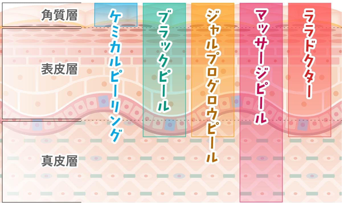 京都院の各ピーリング剤がアプローチする皮膚の深さ(角質層・表皮・真皮)の図解