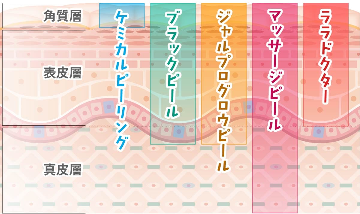 京都院の各ピーリング剤がアプローチする皮膚の深さ（角質層・表皮・真皮）の図解