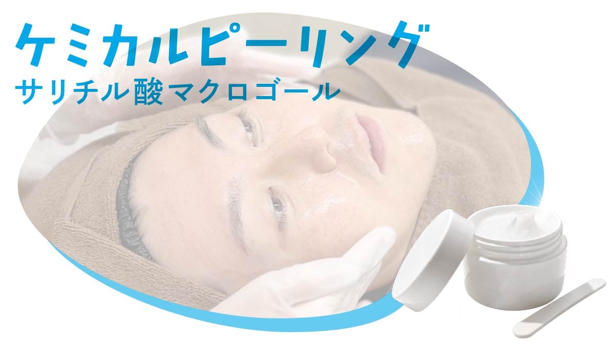 京都でニキビ・毛穴詰まりを改善するケミカルピーリング(サリチル酸マクロゴール)