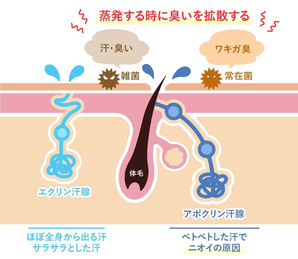 ワキガのニオイの元(アポクリン汗腺)と多汗症の元(エクリン汗腺)の違い