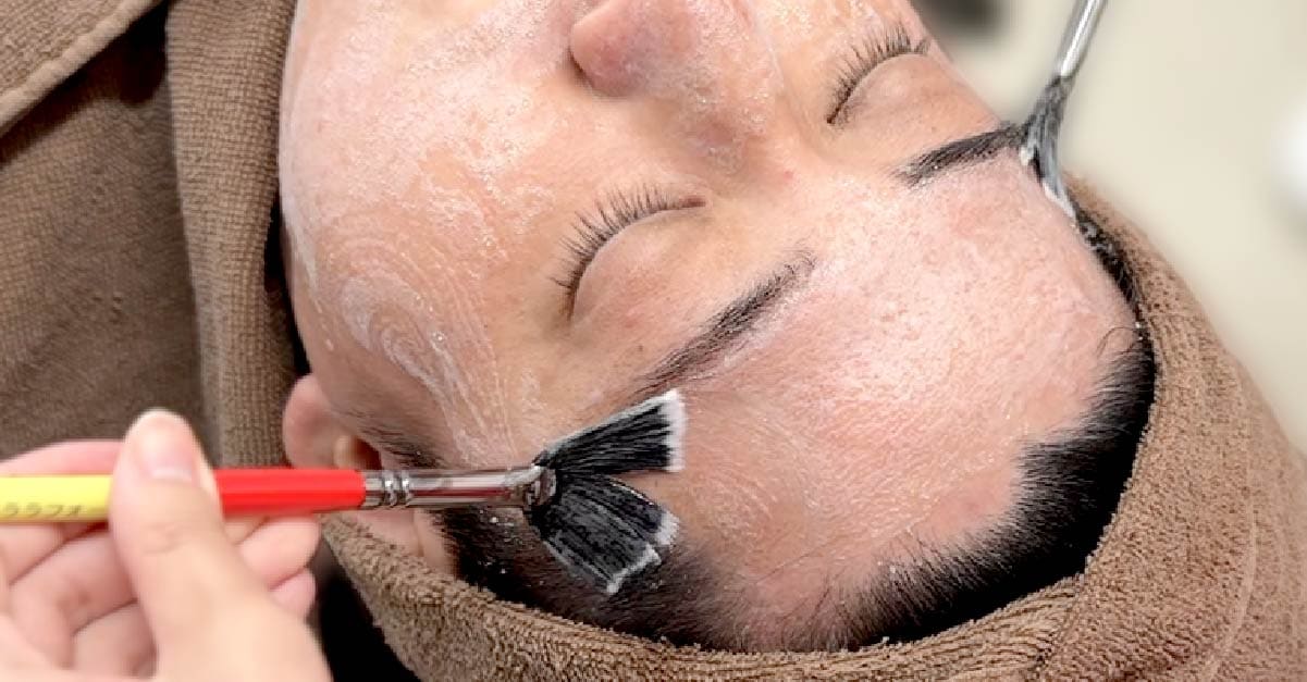 アトピー肌の看護師がララドクターを受けた様子