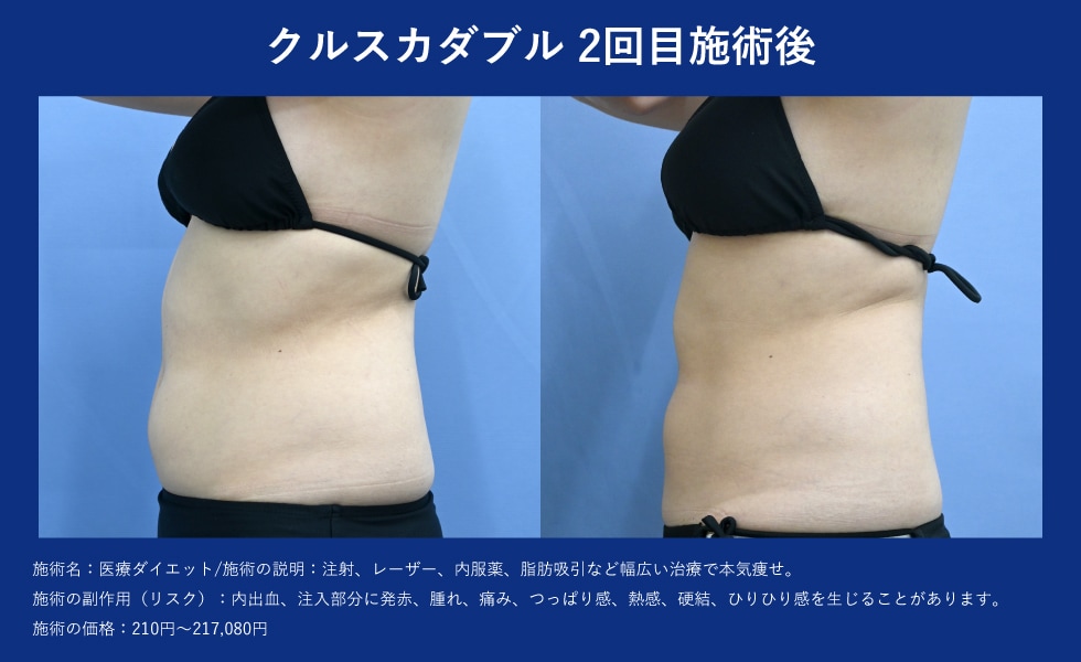 スタッフが受けた！クルスカのビフォーアフター