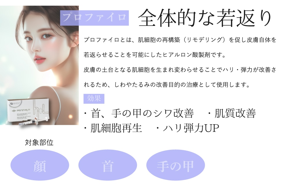 プロファイロ