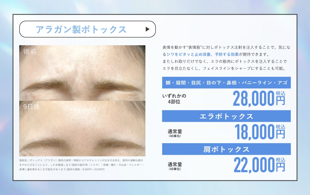アラガン製ボトックス