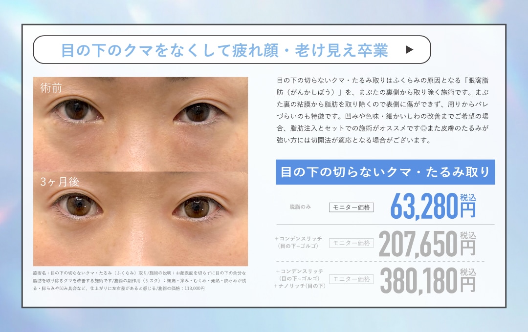 クマ取り