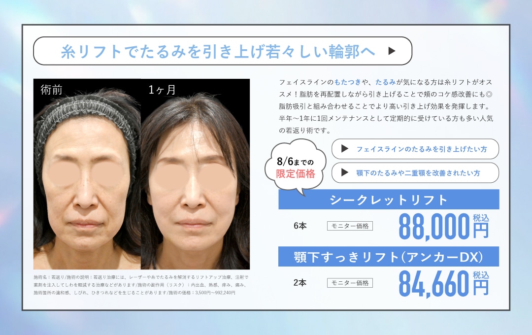 糸リフト