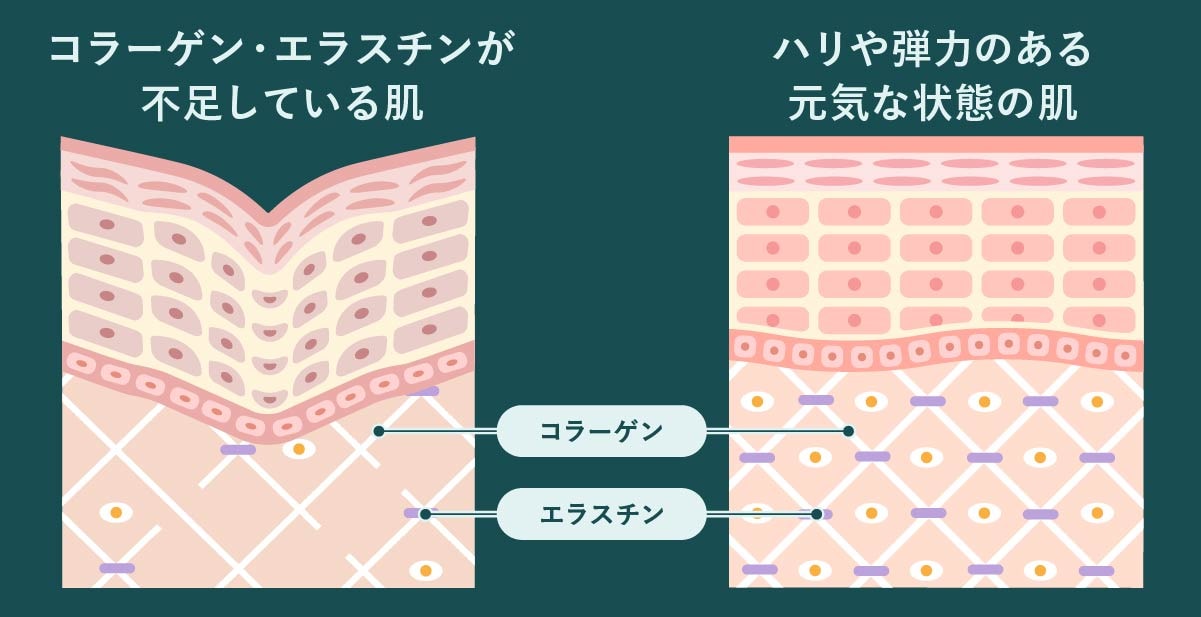 肌質改善