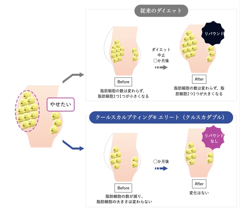 クルスカダブルの仕組み