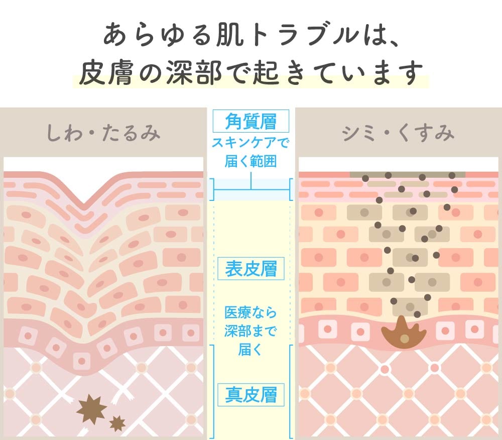 美容医療とエステの肌へのアプローチ層の違い