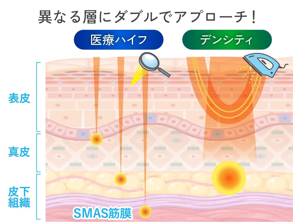 デンシティ×ハイフのイメージ