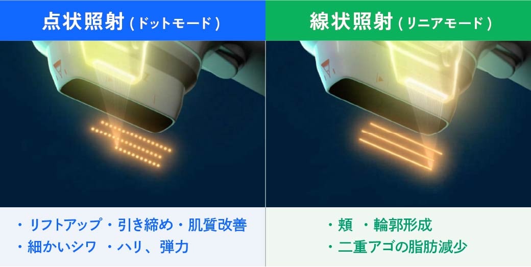 ドット照射とリニア照射の違い