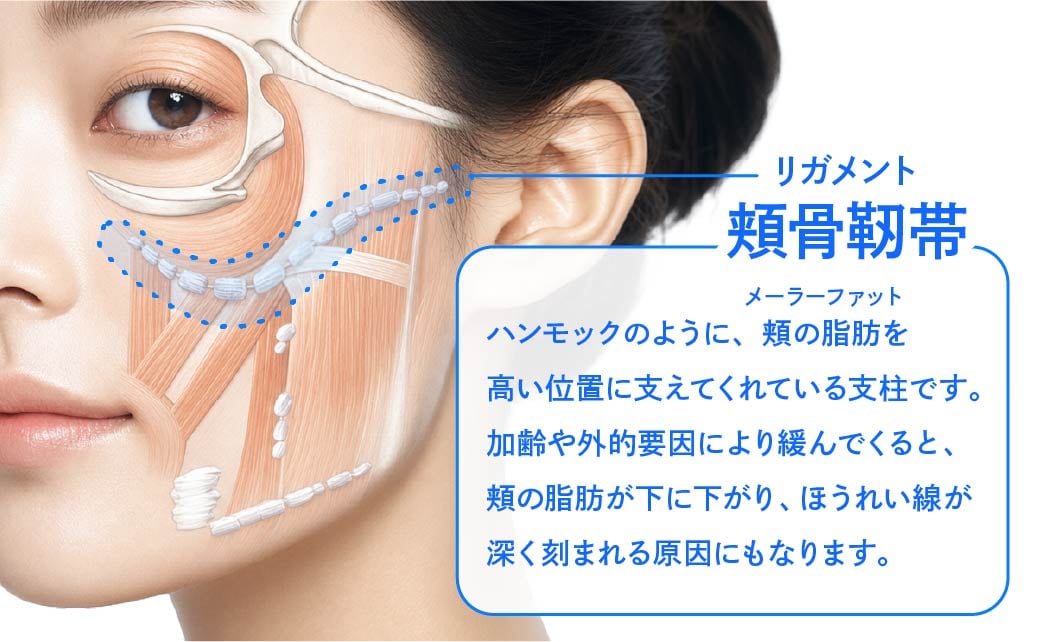 SMAS筋膜と頬骨靱帯へのアプローチ図解