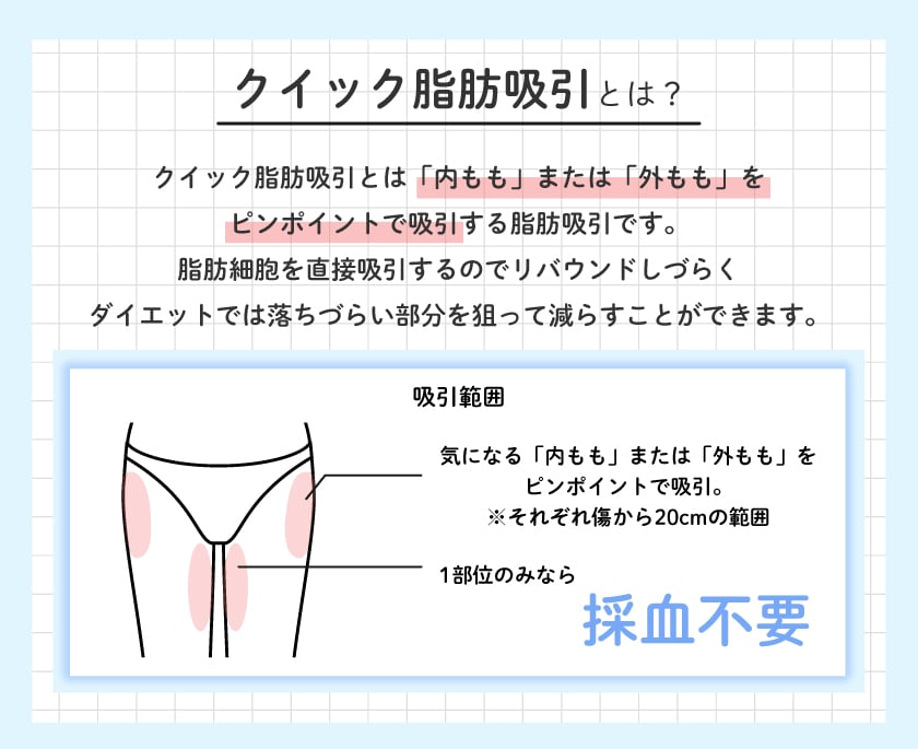 クイック脂肪吸引ってどんな治療？