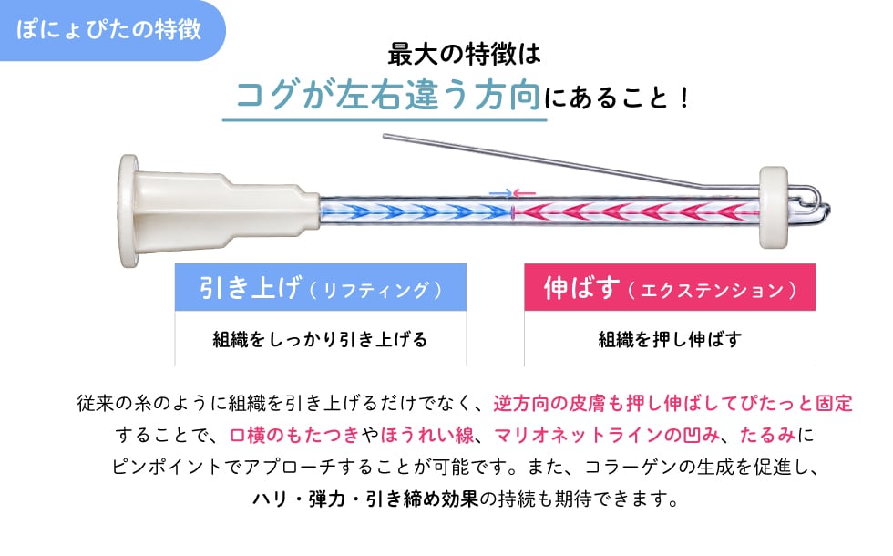ぽにょぴたスレッドの特徴