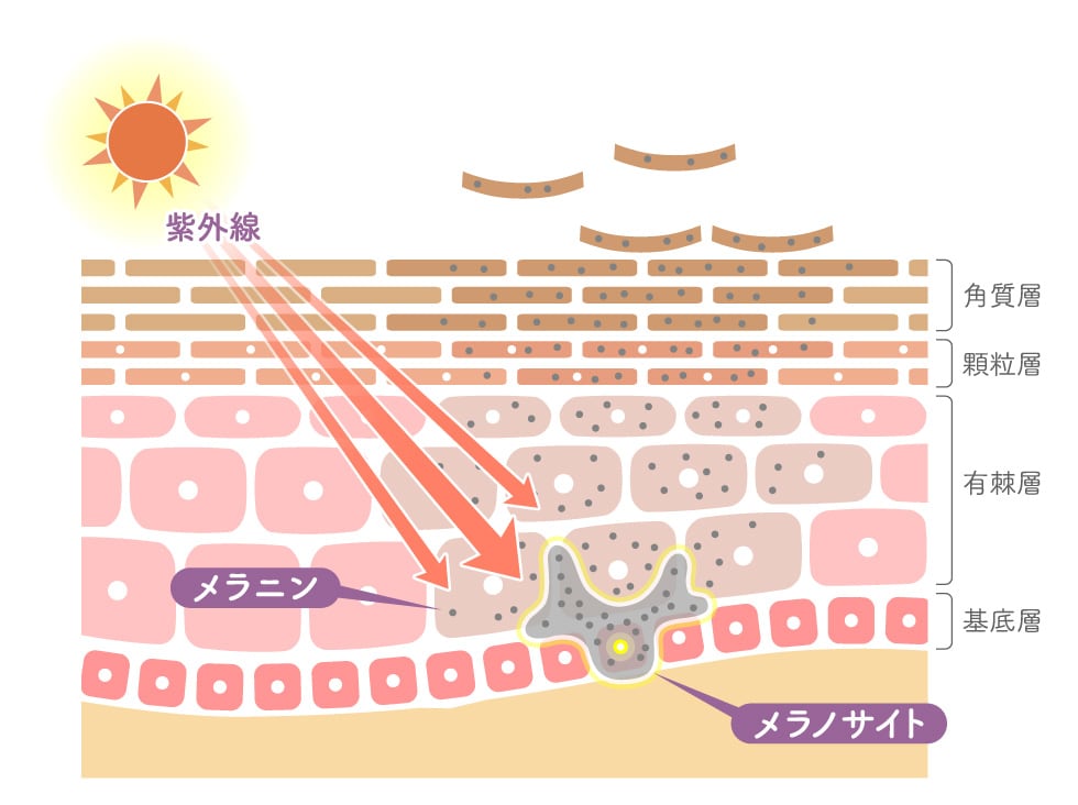 シミができるメカニズム