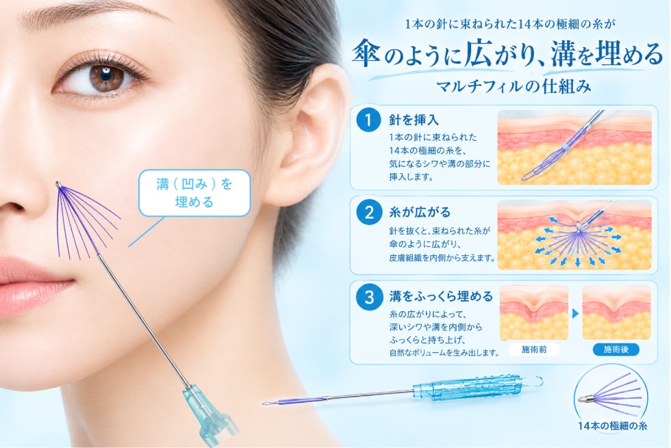 マルチフィルの仕組み