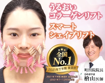シェイプリフト （スマートシェイプリフト｜若返り・エイジングケア 