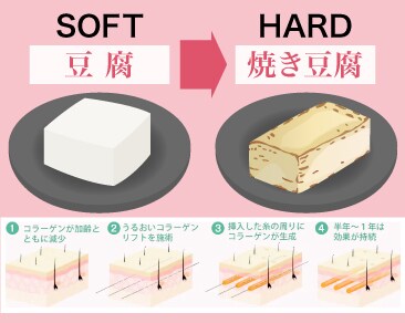 美容針の役割は?