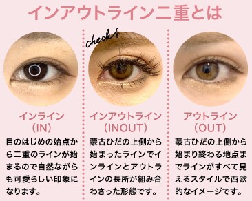 「インアウトライン二重」とは何?