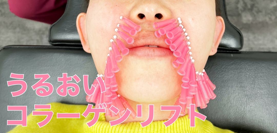 うるおいコラーゲンリフト